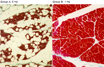Histologischer Befund